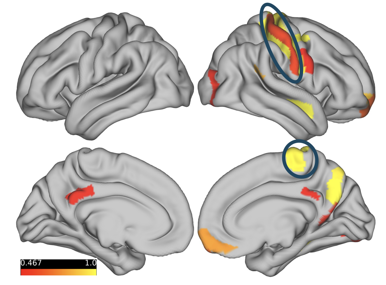 brainmap diagram